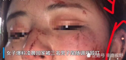 成都市某小区女子凌晨买饭回家路上遭三男子尾随抚摸 反抗之下被殴打