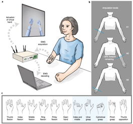 解析肌电信号,用智能义肢控制单个手指,Nature子刊报道
