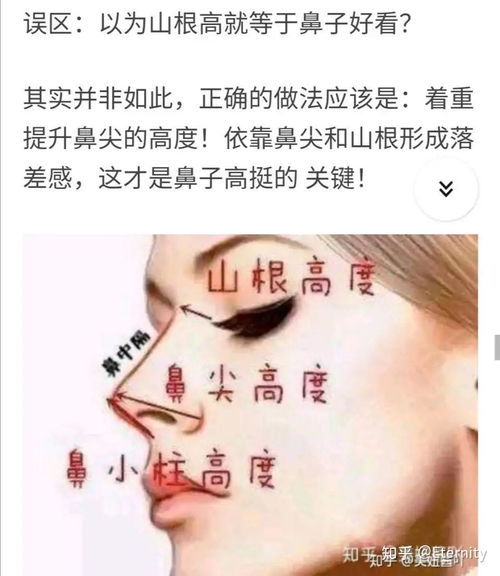 鼻子高但是山根低是什么样 