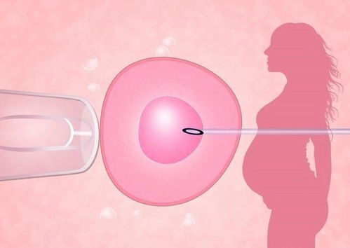 不孕疑问：子宫内膜异位症适合做试管助孕吗？