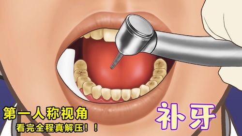 第一人称视角修牙,给帅小哥修蛀牙,看完全过程真解压 