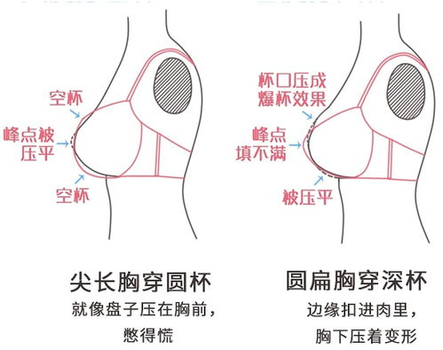 科普 纺锤胸选内衣新技能Get 