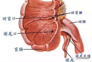 小孩也会得阑尾炎,孩子肚子疼可别大意