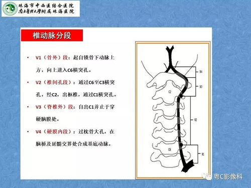 最全的图解头颈部血管解剖及Willis环常见变异