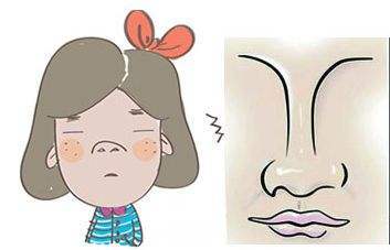 北京善诚卉张维娜对做完不同鼻部的手术需要注意哪些问题