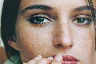 脸上长斑可能是身体哪部分出现了问题 色斑如何形成