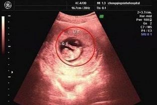 怀孕50天孕囊大小，孕囊大小对照表50天,孕囊大小看男女