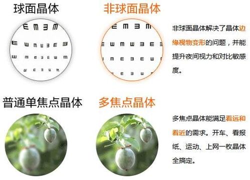 植入多焦点人工晶体术后效果怎么样 老太太说了三个字