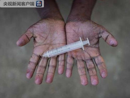 印度冒牌村医用1支针头给多人注射 至少33人染艾滋