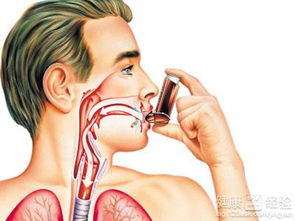 小儿支气管哮喘的治疗方法