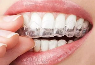 整牙只是青少年专利 错 看牙医全面解答整牙8大问题 