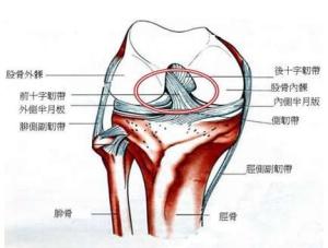 十字韧带损伤
