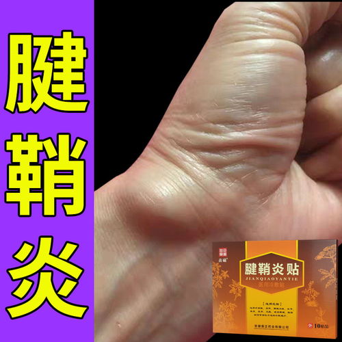 腱鞘炎膏药贴手指大拇指麻木疼痛手腕鼓包腱鞘囊肿贴