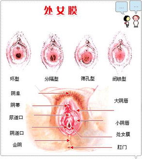 高清图：处女膜的生理构造及变化
