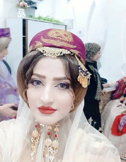 伊朗24岁的美貌新娘,在婚礼上殒命,被 庆祝的子弹 击穿头骨