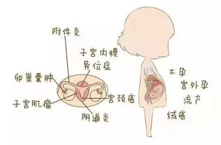 一张 女性妇科疾病 地图,揭示女性不同阶段的生理特点 