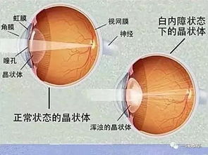 常玩手机的朋友 眼花了视力降了,快用此法,一周见效 