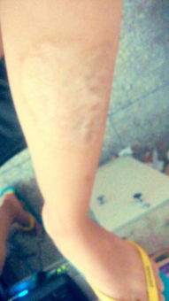 我小腿上有个疤,刺什么纹身好看 