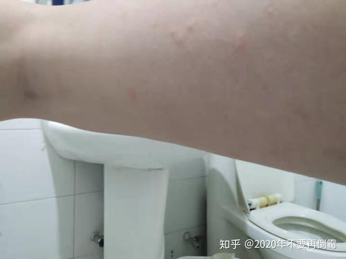 自如怎么才可以办理无责退租 