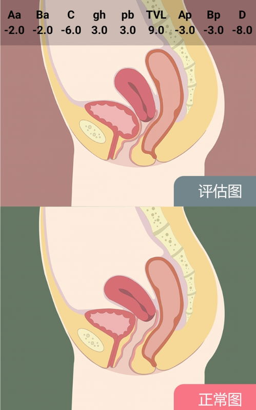 高龄 孕产妇 多次分娩,这几个词让你揪心吗