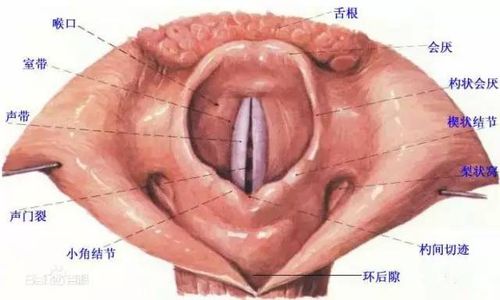咽部异物 咽喉哪处是异物滞留之处