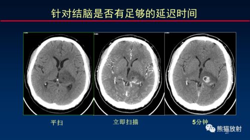 如何写出高质量的CT报告