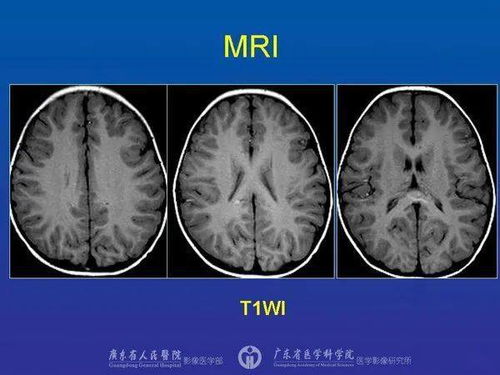 儿童神经影像诊断