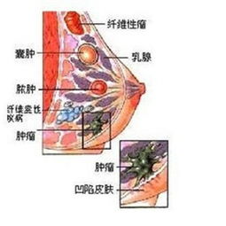 羊乳房有肿块怎么回事 