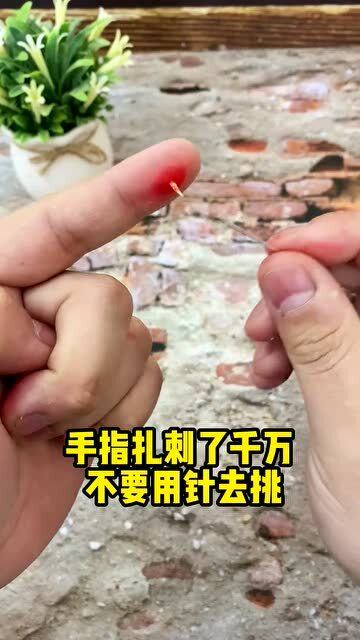 手指扎刺了千万不要用针去挑,容易沾染上细菌 