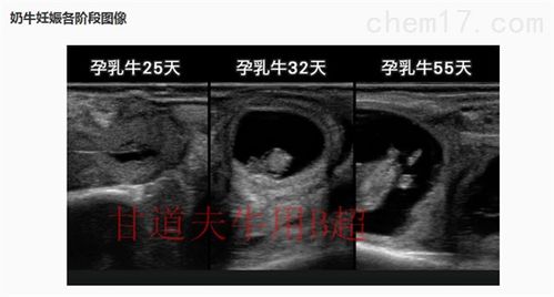 照片定制边框怎么弄好看 孕期b超单照片框怎么做