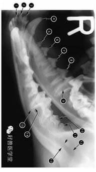 颈椎张口位x线 搜狗图片搜索