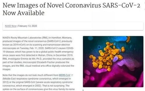 新冠病毒图片真实显微镜（新冠病毒显微照片） 第1张