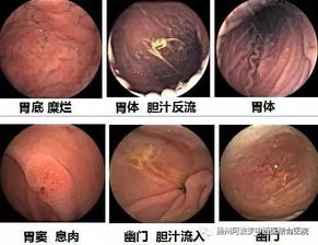 帕夫林可以用于哪些病症？