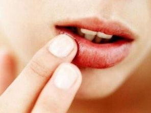 如何认知嘴唇变色的疾病前兆 