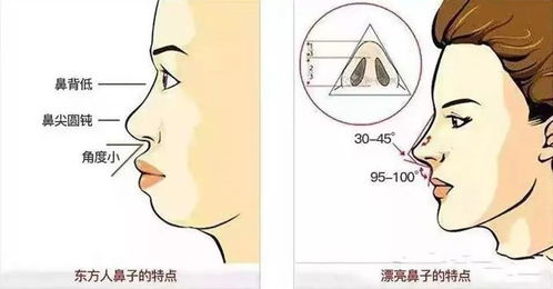 面部扁平又凸嘴 可能是鼻基底凹陷问题