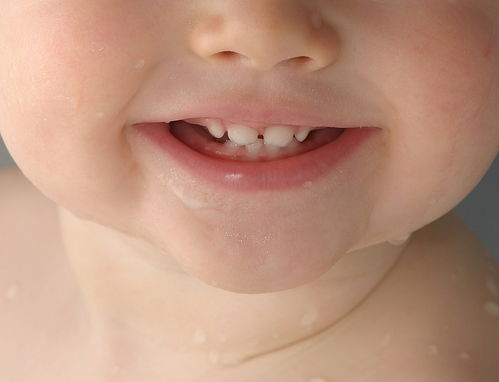 请问一下儿童怎么清洁牙齿(儿童清洁牙齿的好方法)