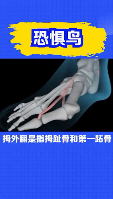 脚拇指外翻的形成以及治疗过程 