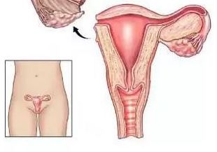 卵巢切除一侧后遗症,切除一侧卵巢的后果...