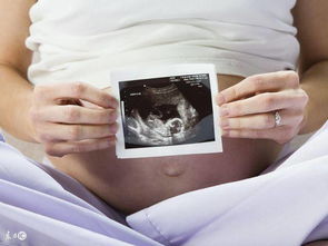 小小刚怀孕不足2月突然出血以为流产,但去医院查完结果更震惊 