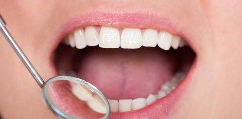 每天坚持刷牙,牙齿为啥还会坏 这3种 毁牙 的习惯,早点改