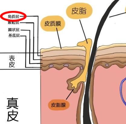 额头上的闭口粉刺如何解决 