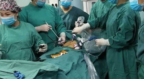 城医技术 妇科成功完成一例单孔腹腔镜手术