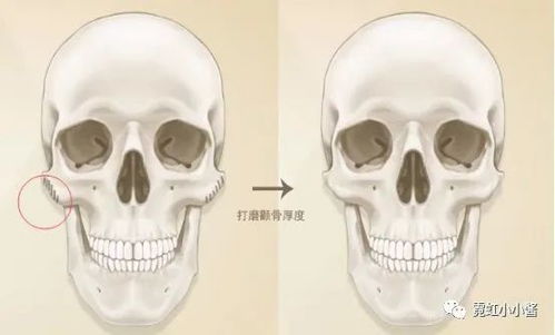 这些显老特征你全中 别怕 还能拯救一下 日本医美