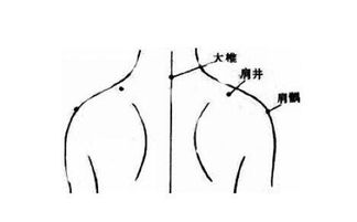 肩井穴穴位的准确位置图