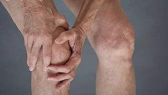 缺钙的后果不只抽筋和腰腿酸痛,还有这个