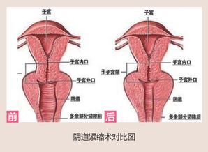 使阴道更“紧缩”的N个秘诀