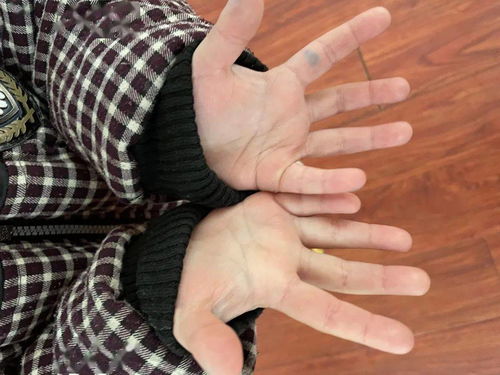 手掌金星丘酸痛,什么是手掌掌丘 手掌八大掌丘解析？
