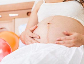 为什么多数孕妇选剖腹产而不选顺产 