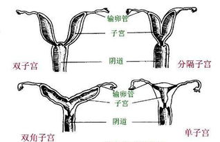 左右开 宫 双子宫女性怀孕生子难,今天是学知识了