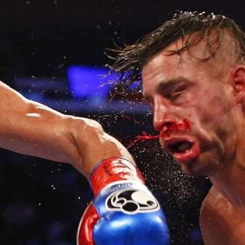 拳击比赛有多危险 这位拳击手被一拳打扁鼻子,力量超400公斤 